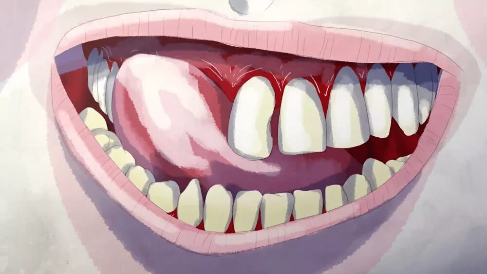 Острые зубы аниме 5